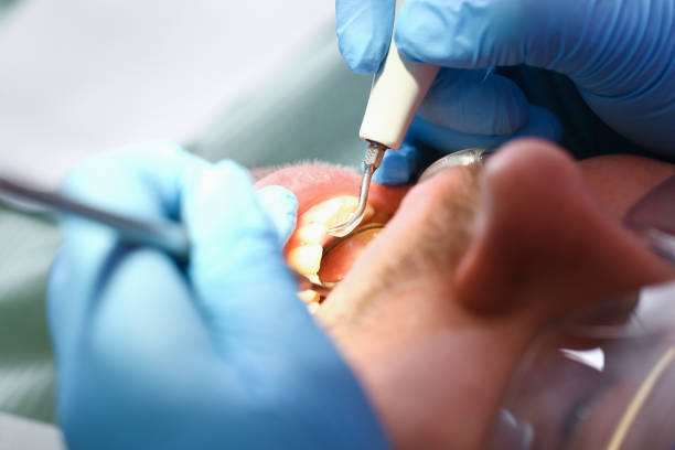 Best Orthodontic Emergency Dentist in Mebane, NC