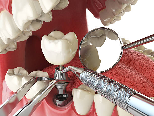 Best Orthodontic Emergency Dentist in Mebane, NC